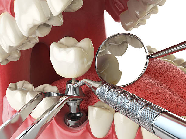 Best Emergency Gum Treatment in Forrest, IL